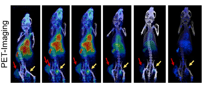 Imaging modalities for cancer