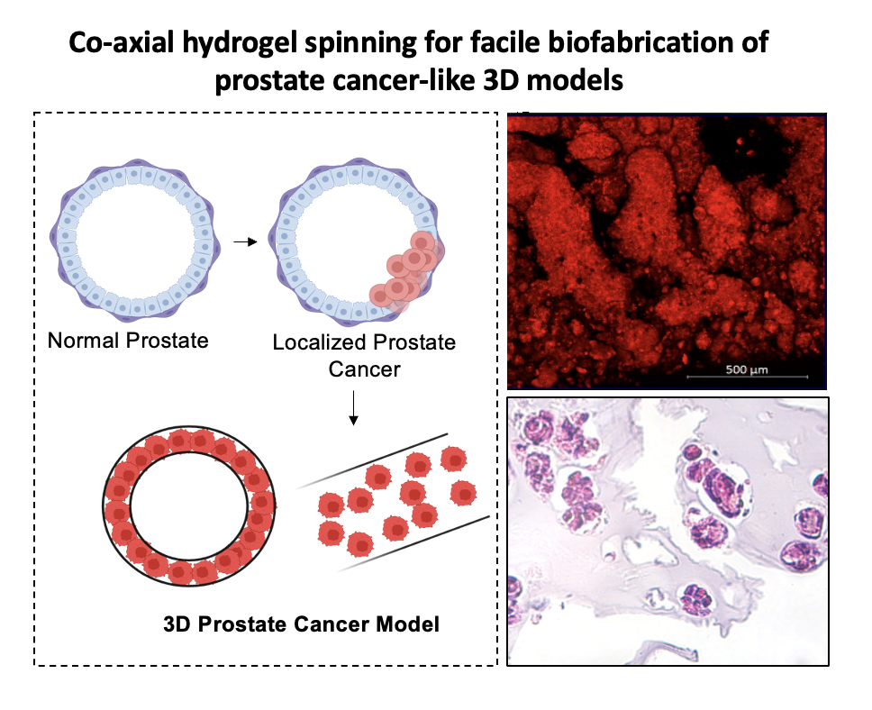 Biofabrication of prostate cancer-like 3D models utilizing co-axial hydrogel spinning